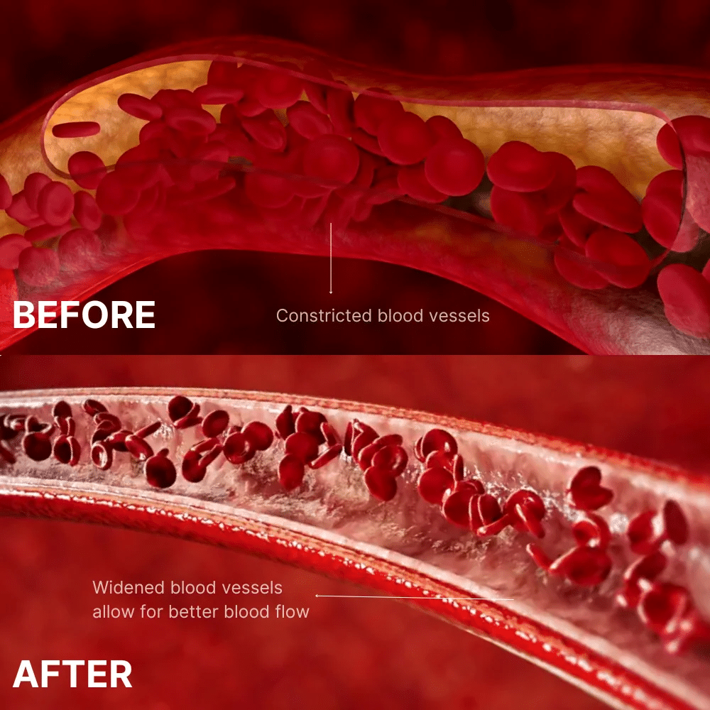 Lozenge Constricted Blood Vessels